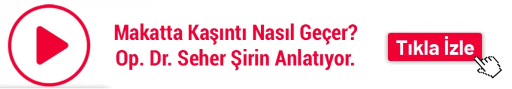 Makat kaşıntısı nasıl geçer